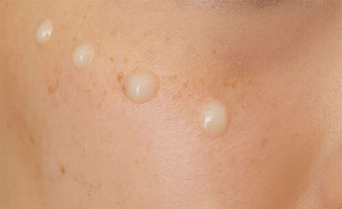 CeraVe Skin Renewing Vitamin C Serum 30 ml - 3