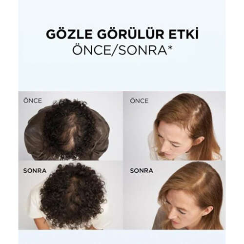 Elseve Growth Booster Dökülme Karşıtı Saç Bakım Kremi 150 ml - 4