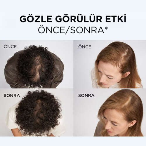 Elseve Growth Booster Saç Derisi Serumu 102 ml - 4