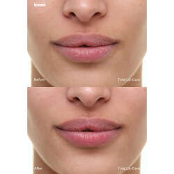 Kremi Total Lip Care 8 ml - 4