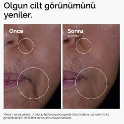 The Ordinary GF 15% Solution Olgun Cilt Destek Solüsyonu 30 ml - 3